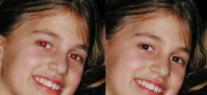 Abbildung 4: Die meisten Bildbearbeitungsprogramme bringen das passende Werkzeug mit, um rote Augen problemlos zu korrigieren.