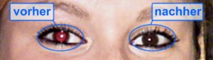 Abbildung 6: Rote Augen mache ein Bild unbrauchbar, sind aber nicht allzu schwierig zu entfernen.