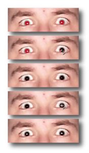 Abbildung 6: Das sind die grundlegenden Arbeitsschritte, um den Rote-Augen-Effekt zu entfernen