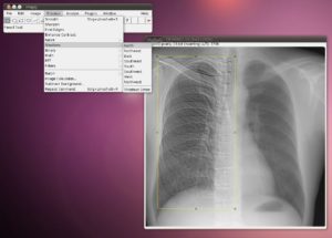 Abbildung 4: Der DICOM-Betrachter ImageJ bietet sogar Funktionen zur Bearbeitung und Analyse von Bildern.